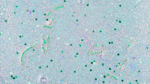 Estudo revela presença de microplásticos no cérebro humano