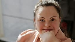 Mulher com síndrome de Down apresenta Alzheimer sem demência