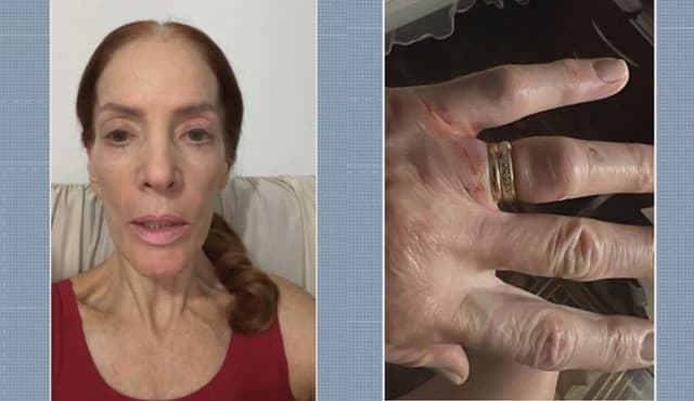 Médica assaltada muda rotinas após agressões em SP