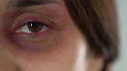 Cresce a violência contra mulheres no Brasil em 2025